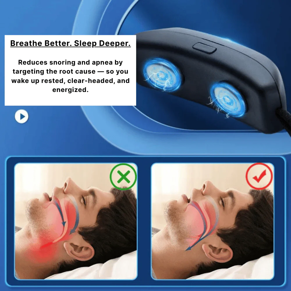 Smart Anti Snoring Device | Comfortable Sleep Assistant