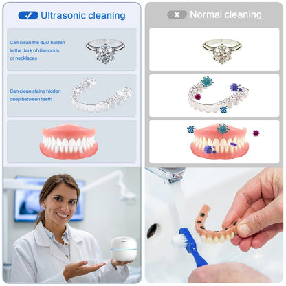 Pure Ultrasonic Dental Cleaner Pro for Appliances - Luxyecs
